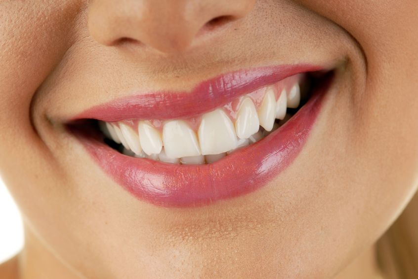 Citadel Dental’s Dentistry Services in St. Albert: Getting Your Best Smile