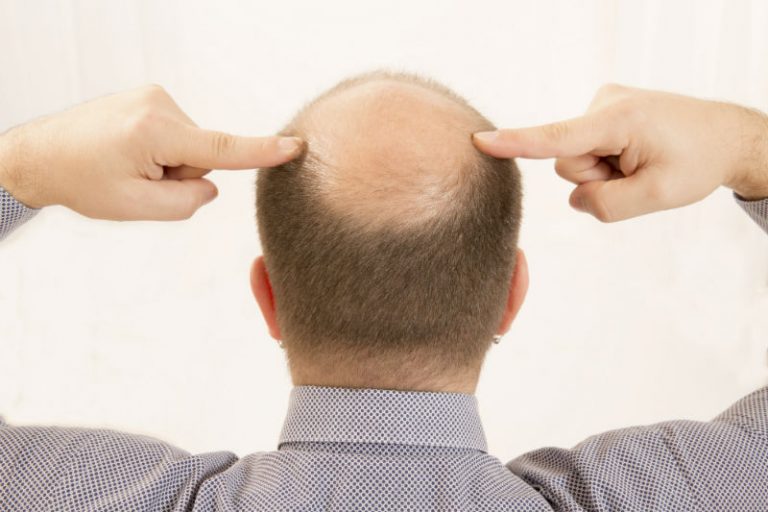 Transform Your Look and Confidence with Hair Transplants in New Jersey