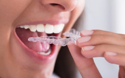 Benefits Patients Experience From Braces In Medina OH Specialists Use For Straighter Teeth