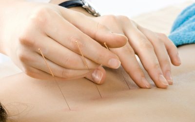 Experience natural relief from chronic pain with acupuncture in Union City, CA.